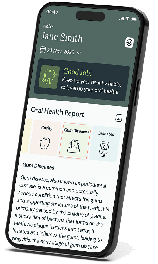 OG Consumer Phone v01 2